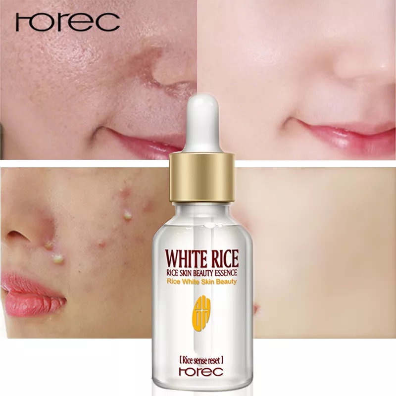 WHOLESALE Rorec Best Skin Care Moisturizing Essence Anti Aging Whitening Facial White Rice Serum