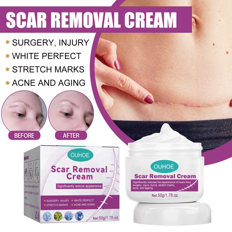 OUHOE Scar repair cream伤疤修护膏 | Shopee Malaysia