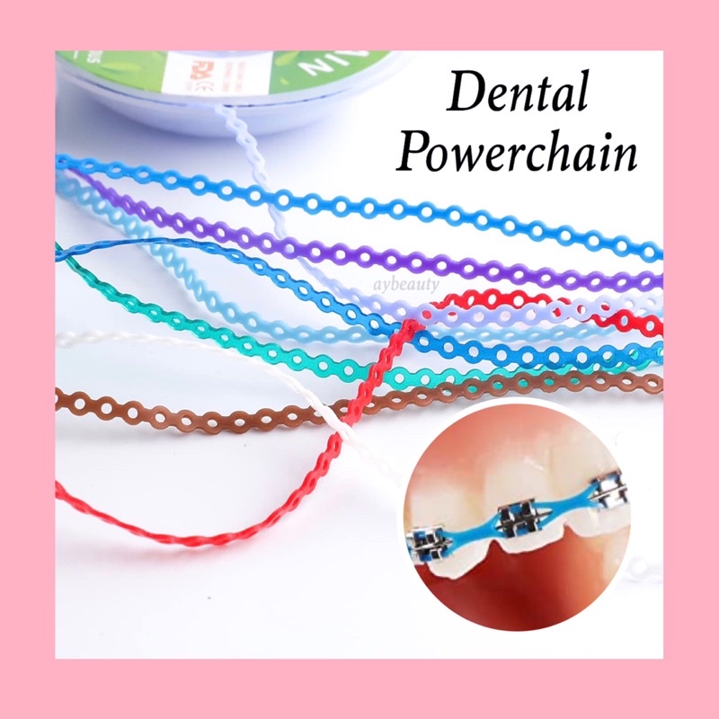 Getah Powerchain Gigi Atasbawah Elastic / Ligature Ties Braces Ready