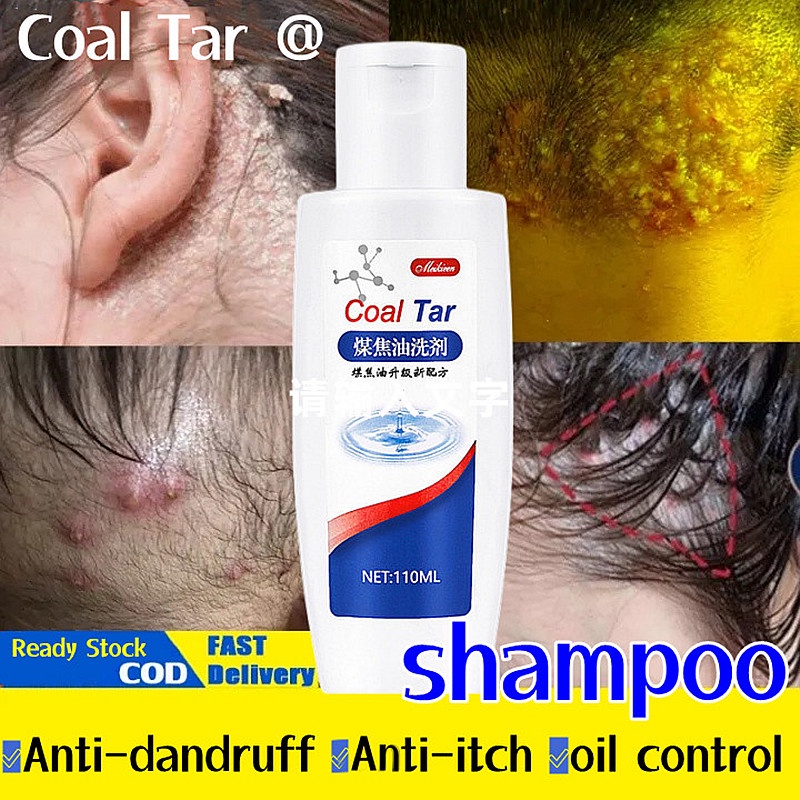 shampoo kelemumur anti dandruff shampoo coal tar shampoo syampoo