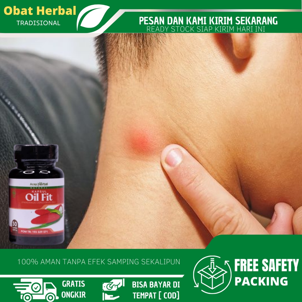 Neck Lumps Medicine, Neck Lumps Remover, Thyroid Gland Medicine