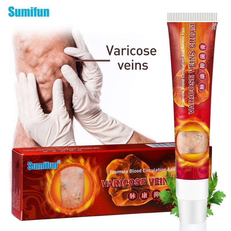 Sumifun Varicose Veins Cream Varicosity Angiitis Cream Relief脉康抑菌膏 改善静脉 ...