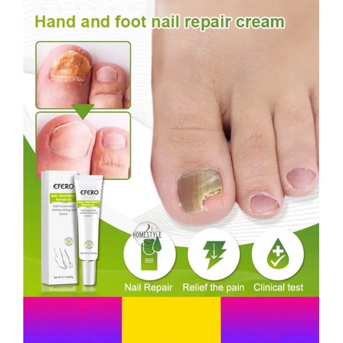 EFERO Hand and Foot nail repair cream Fungal Nail Treatment Nail Fungus Removal Gel Anti