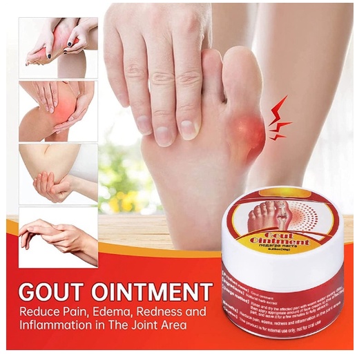 Gout Treatment Cream | Gout Pain Relief Ointment 痛风膏 | Shopee Malaysia