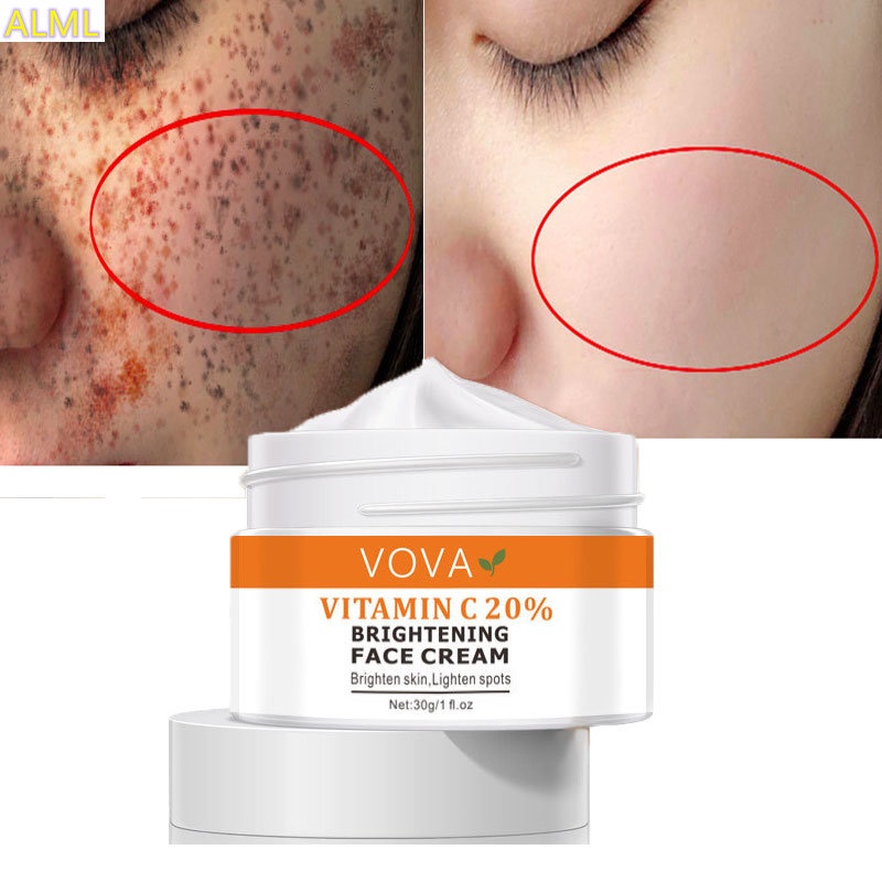 VOVA Vitamin C Freckle Whitening Cream Remove Dark Spots Pigment Fade