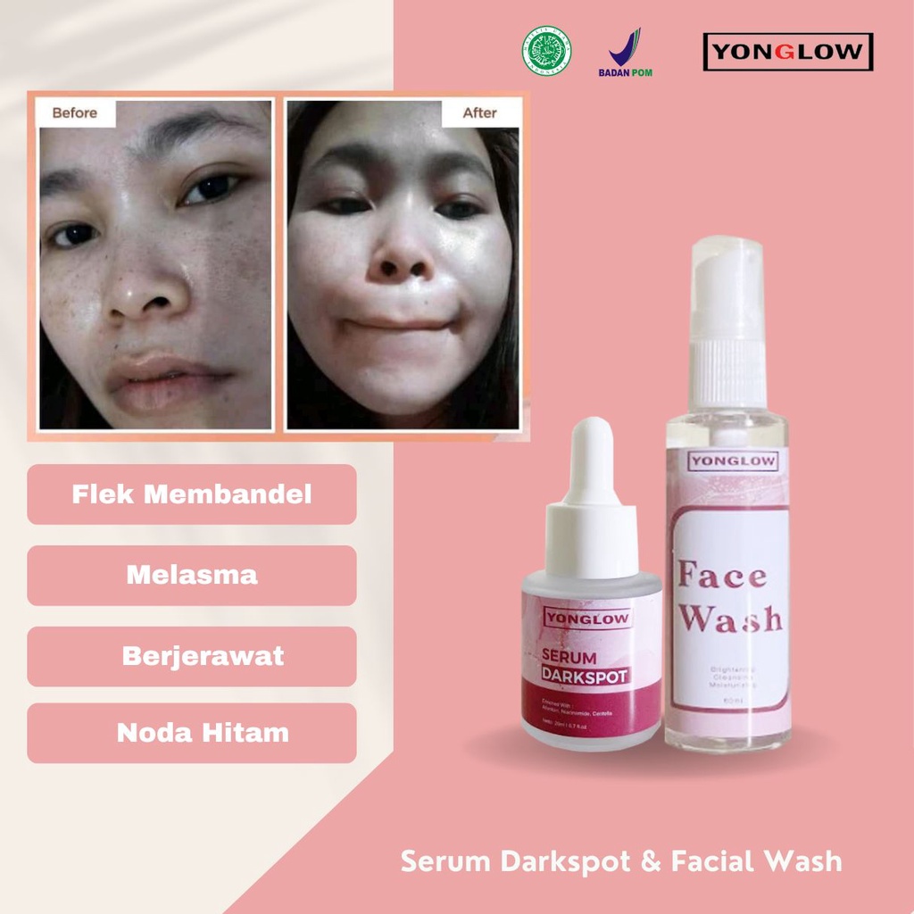 HITAM Yonglow Skincare Package 2in1 Serum Darkspot Facial Soap Facial