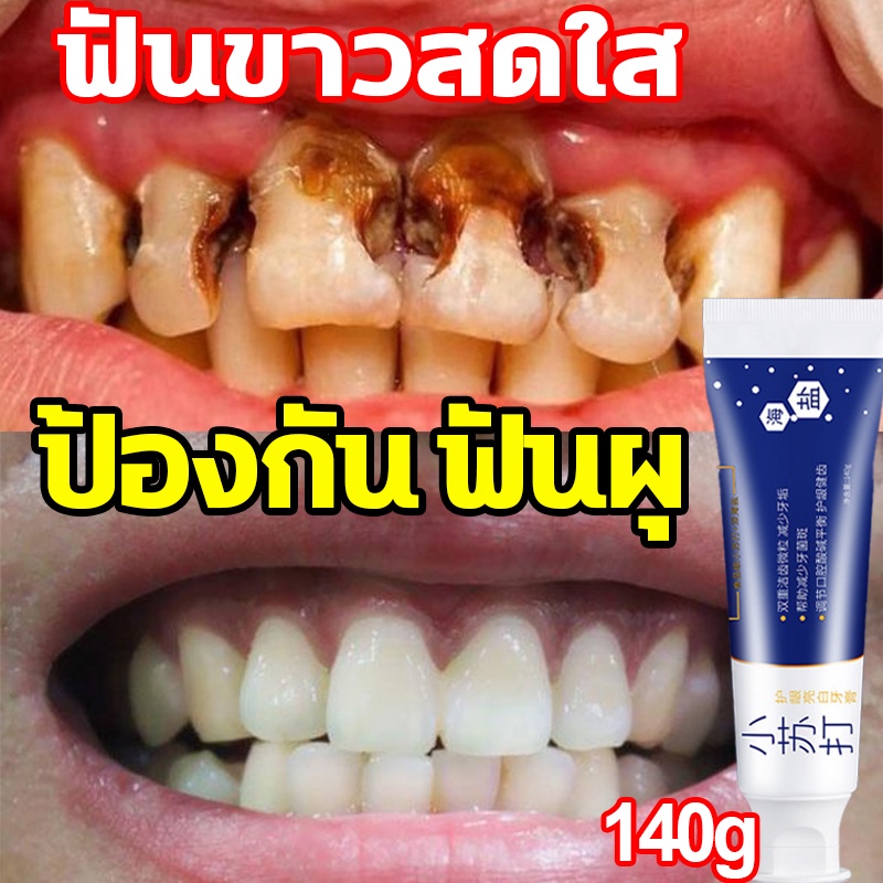 Toothpaste Baking Soda 140g Teeth Whitening Cure Yellow Teeth. Teeth