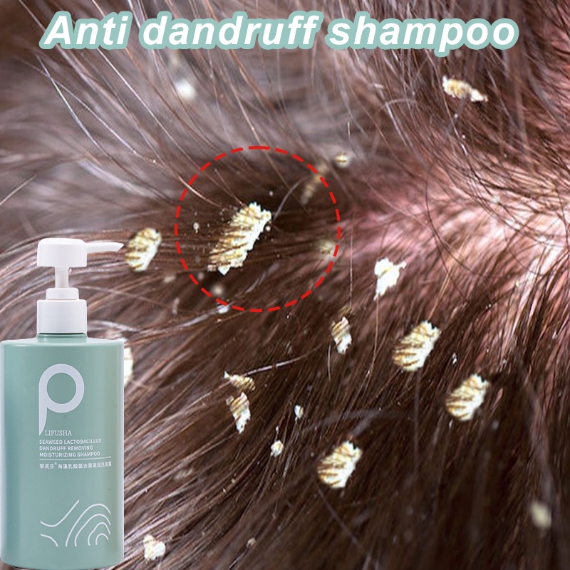 shampoo kelemumur ubat kelemumur kepala syampoo kelemumur anti dandruff