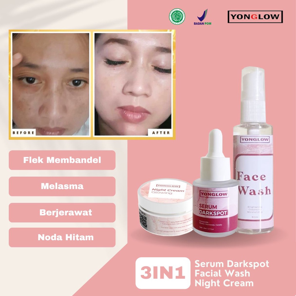 HITAM Yonglow Skincare Package 3in1 Serum Darkspot Night Cream Day