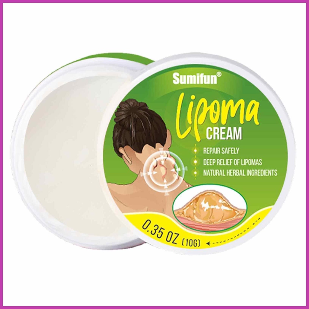 Lipoma Remover 10g Instant Lipoma Removal Cream Lipoma Lumps Removal