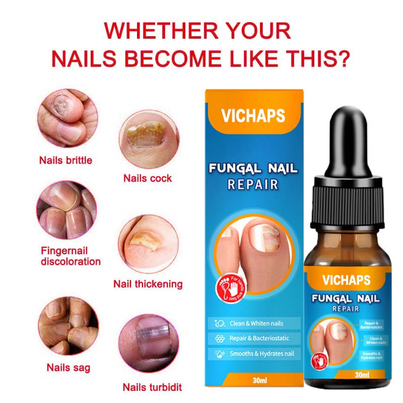 Nail Fungal Treatment, Toenail Treatment Extra Strong Nail Repair