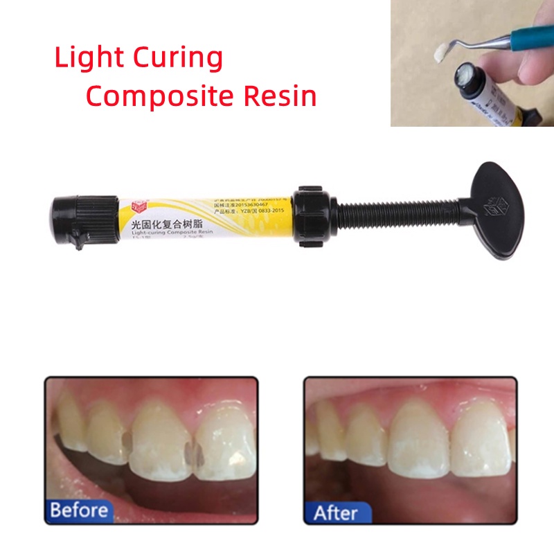 Universal Dental Light Curing Composite Resin Dental Filling Resin