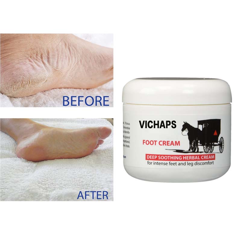Horse oil Foot Cream No Pumice Stone Callus Remover Moisturizes