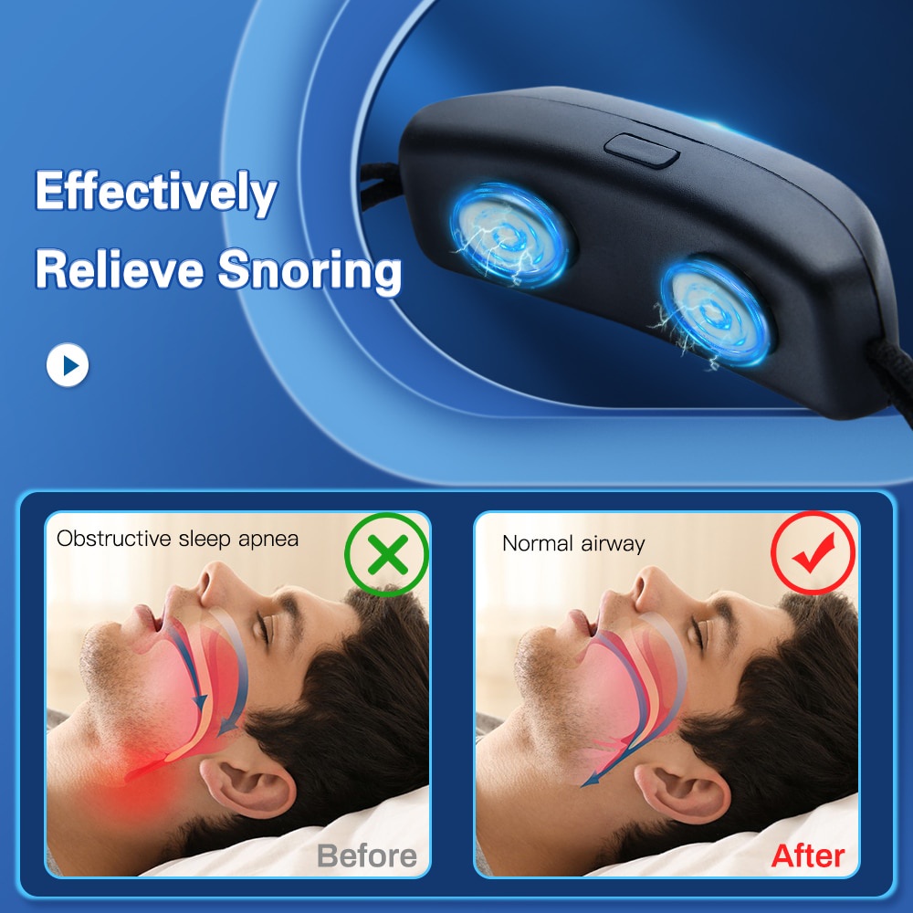 Smart Anti Snoring Device EMS Pulse Stop Snore Aid USB Rechargeable ...