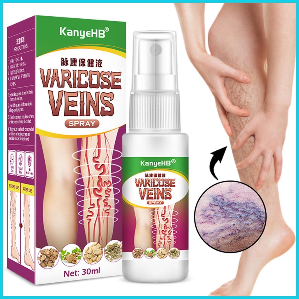 30ml Herbal Varicose Vein Care Effective Care Leg Acid Vasculitis