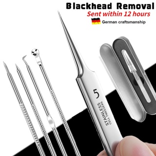 Ingrown Hair Tweezers Needle Nose Pointed Tips Eyebrows Tweezers