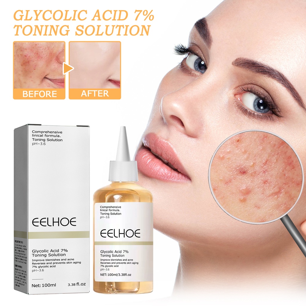 EELHOE Glycolic Acid 7 Toning Solution 100ml Acne Remover Acne