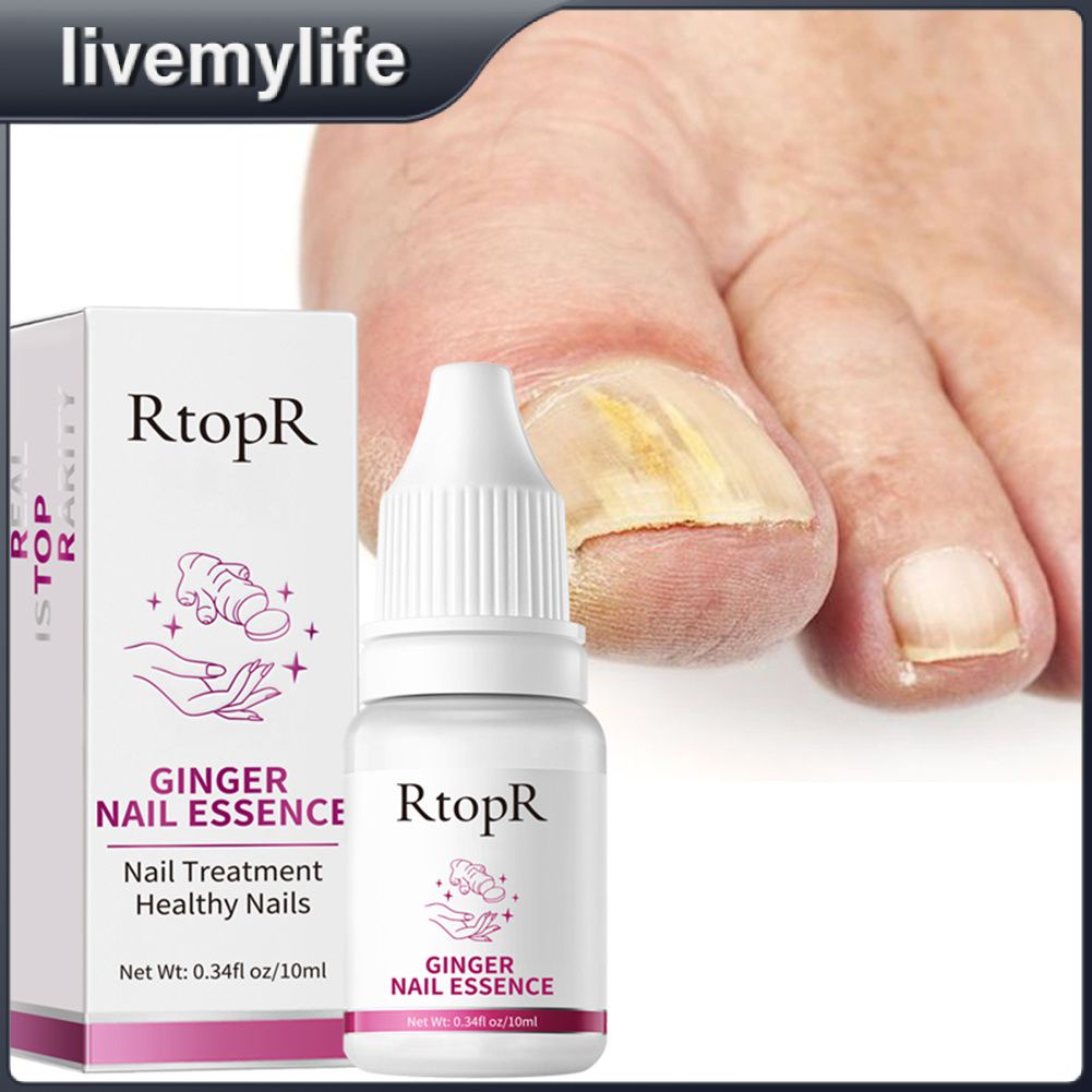 RtopR Ginger Antibacterial Nail Treatment Essential Anti Fungal