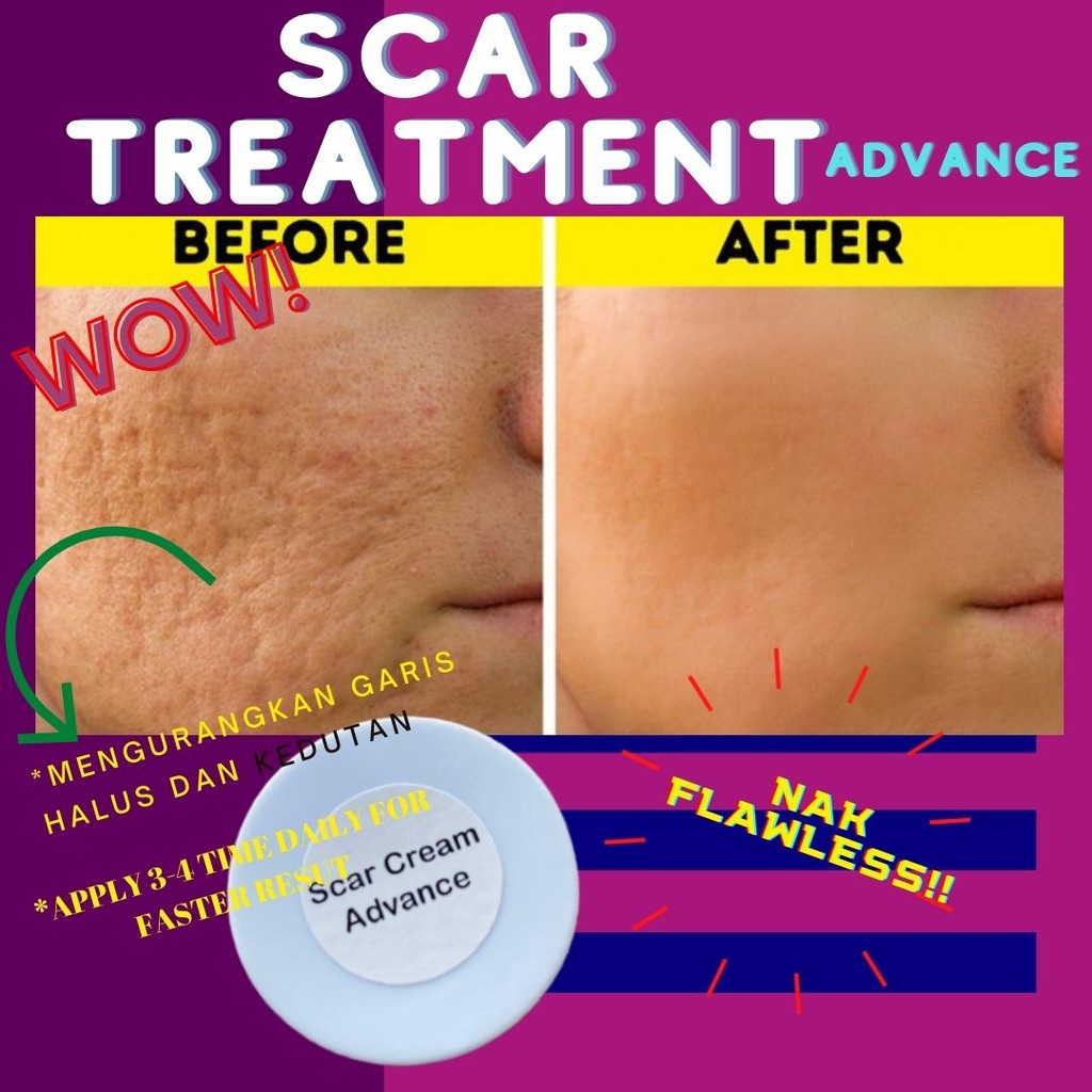 Dermal Fibro Scar Glutathione Insect Bite Parut Badan Kudis Parut Kaki Go Away Body Care 15ml