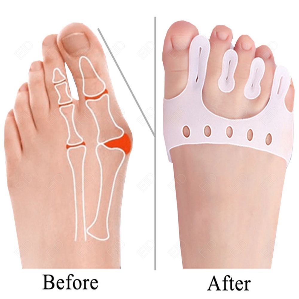 EiD Five Toe Separator Silicone Forefoot Pads Cushion Pad Pain Relief ...