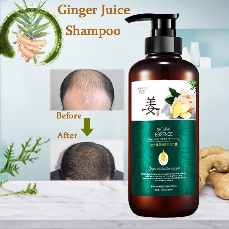 ZenShow Ginger King Hair Growth Serum & Shampoo ginger hair growth