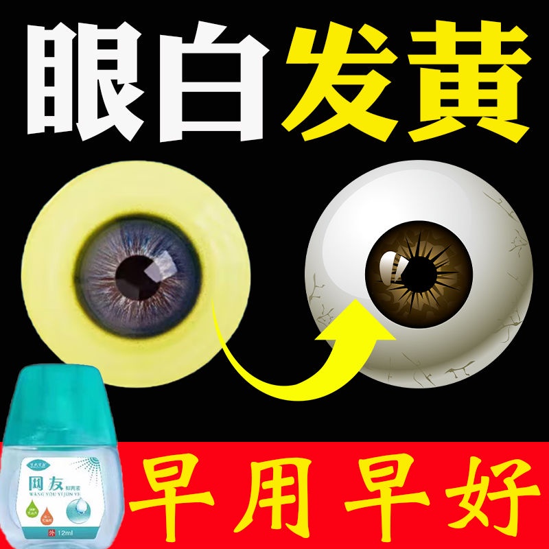 Specializing in Eyes Whitening Yellow Turbid with Red Blood Silk
