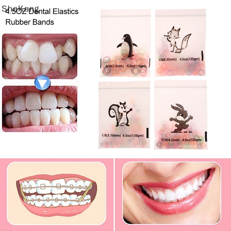SKMY Orthodontic Rubber Bands Ortho Elastics Latex Braces 4 Sizes For