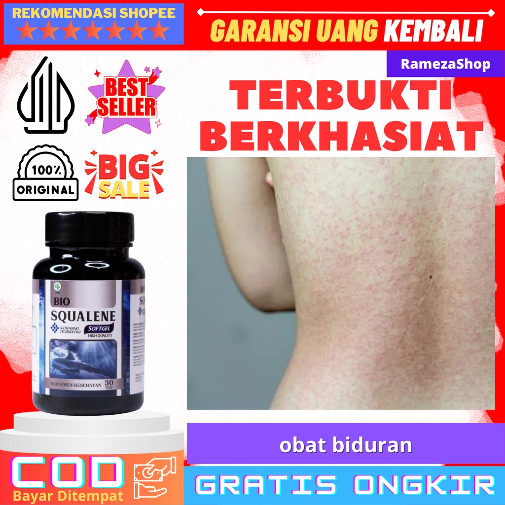 MATA Bintitan Eye Medicine For Bintitan Eye Medicine For Children And Adults Removing Lumps On