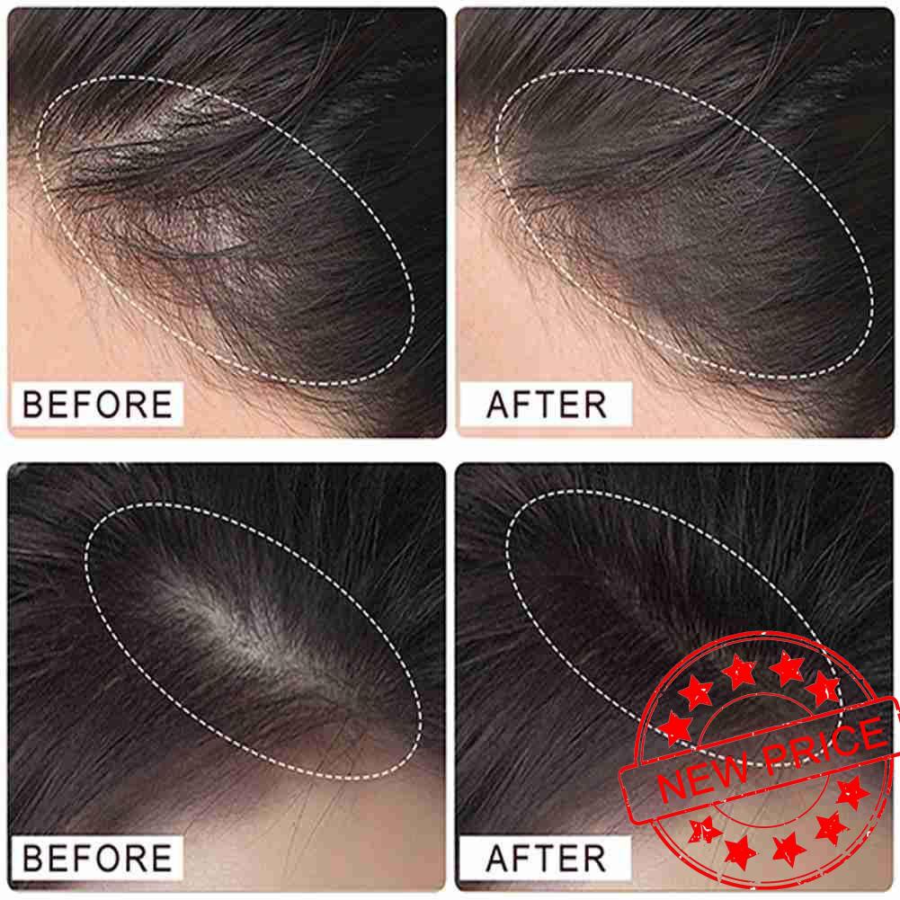 Suake Hairline Shaping Shadow Powder To Fill The Forehead Hair Repair Hairline Artifact X6z4