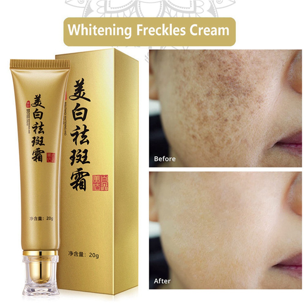 Whitening Freckles Cream Remove Dark Spot Lighten Melasma Melanin Anti Aging Repair Skin