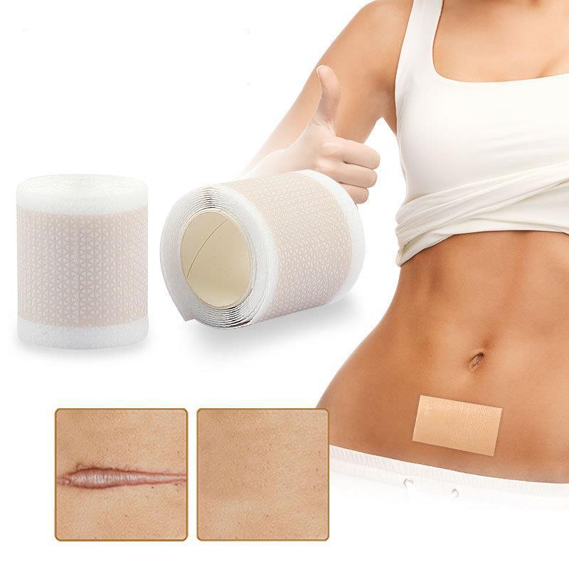Silicone Scars Patches Surgery Corrector Scar Tap Removal Sheet Healing