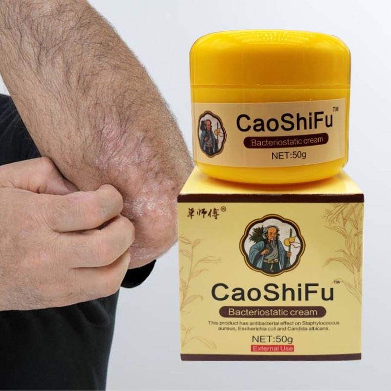 50g Caoshifu Eczema Treatment Ointment Antibacterial Psoriasis Cream Herbal Itching Skin Care 4029