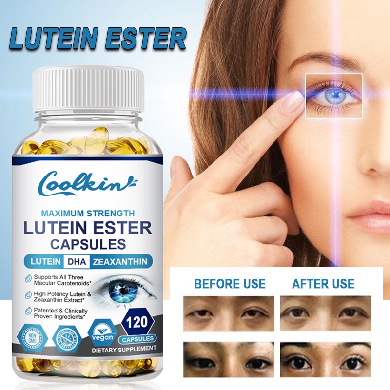 Lutein Singapore, Supplements For Eye Health