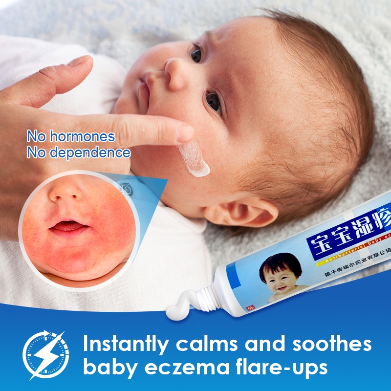Baby Skin Repair Cream Treatment Kids Diaper Rash Psoriasis Dermatitis ...