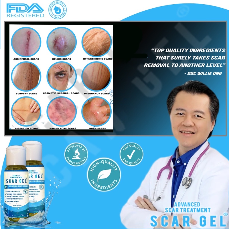 [Value Choice] New 2023 SCAR GEL & Fixscar For Scar Treatment Stretch