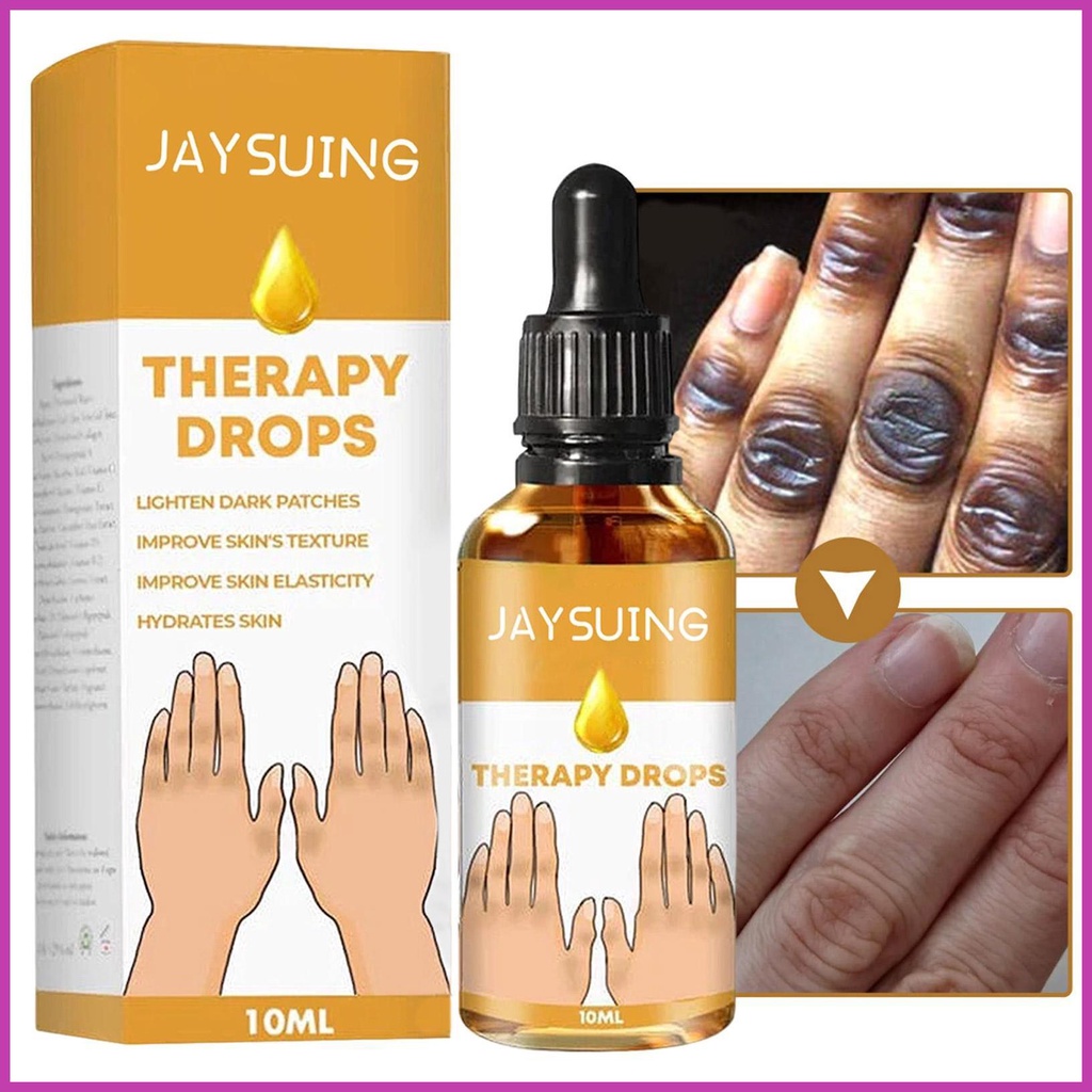 Acanthosis Nigricans Brightening Dark Spots Removal Body Bleaching 10ML