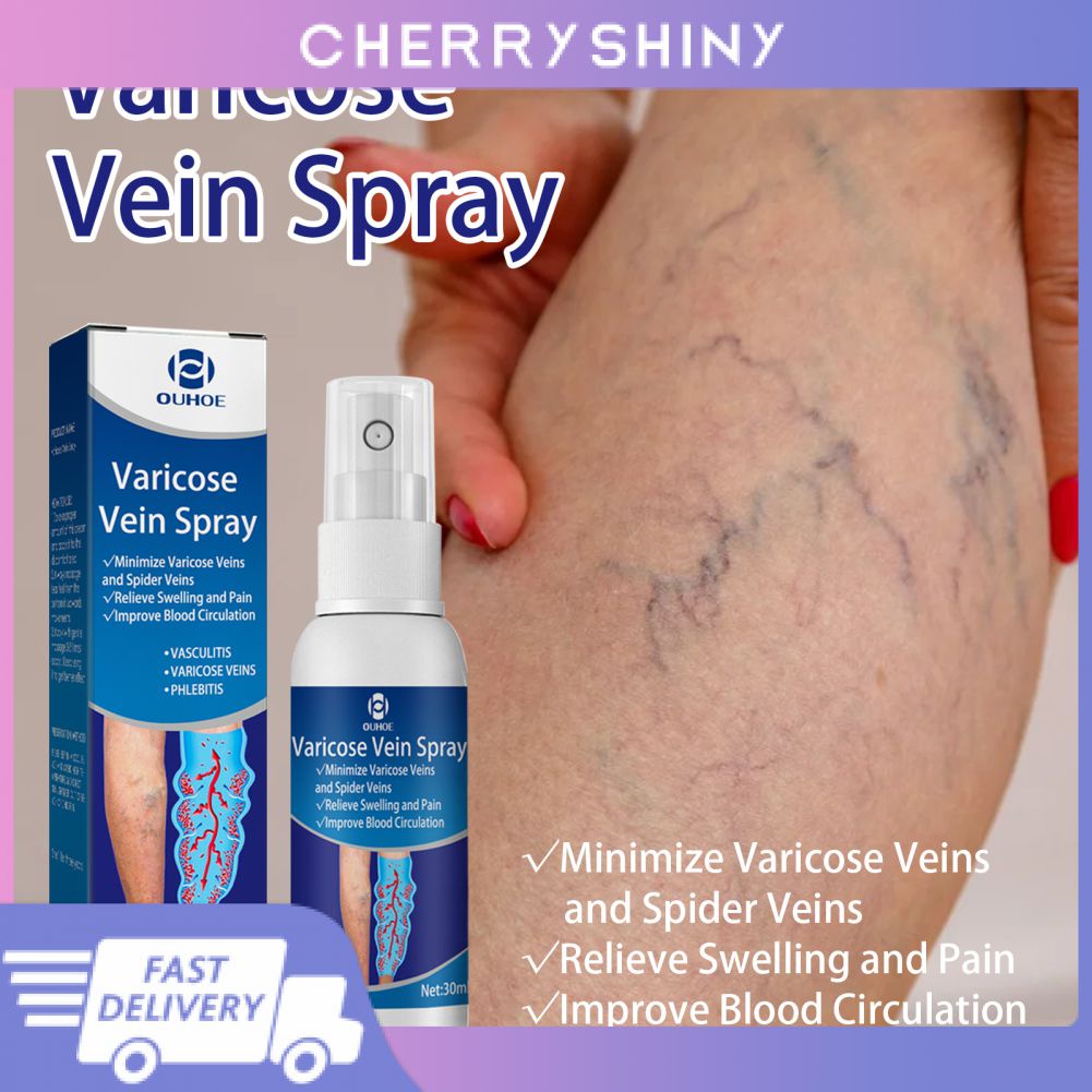 HOT！ Ready Stock Varicose Vein Spray Repair Leg Blood Vessels Bulge