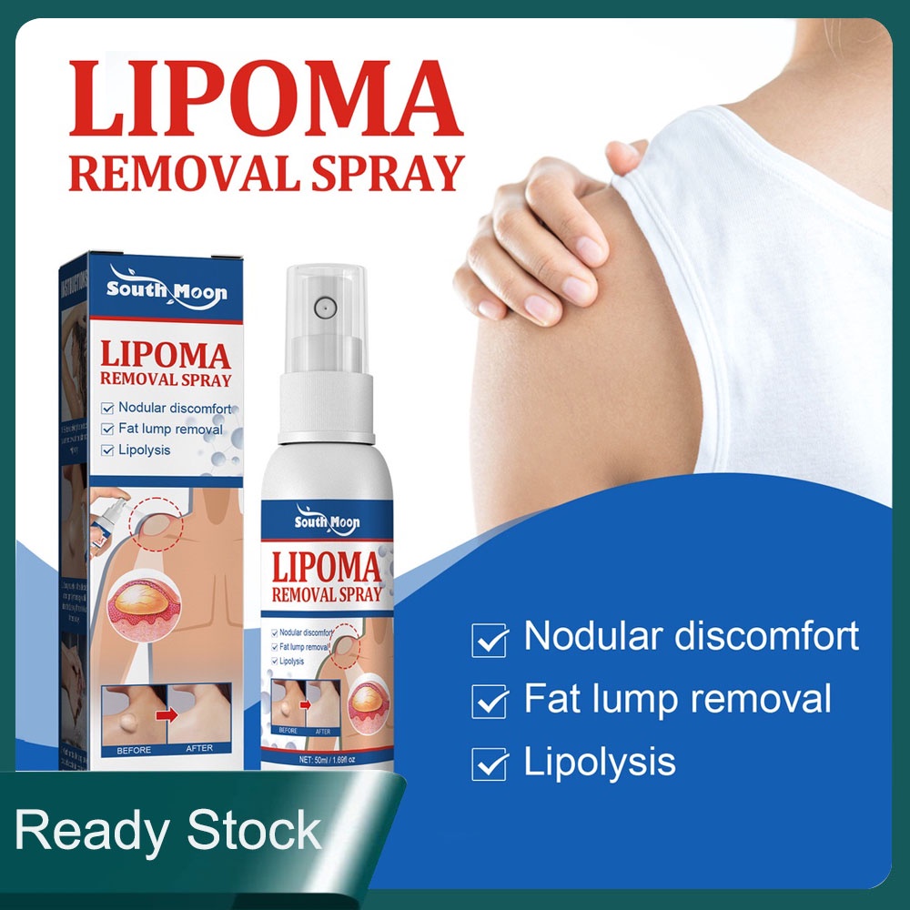 Lipoma Removal Spary Relieve body Fat Lump Tumor Subcutaneous Fat ...