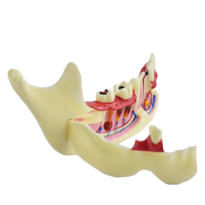 Dental Model Mandible Tissue Model Gums Model Teeth Model | Shopee Malaysia