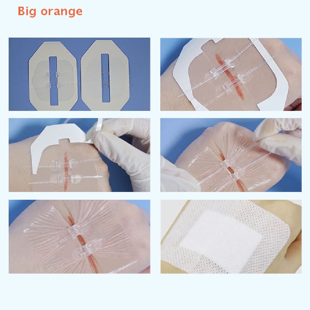 Big Orange Pcs Zipper Band Aid Suture Free Wound Dressing Patches