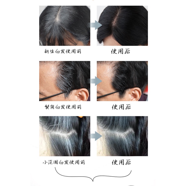Pewarna Rambut Segera 20ml Tutup Uban & Rambut Putih Serta-Merta, Kalis ...