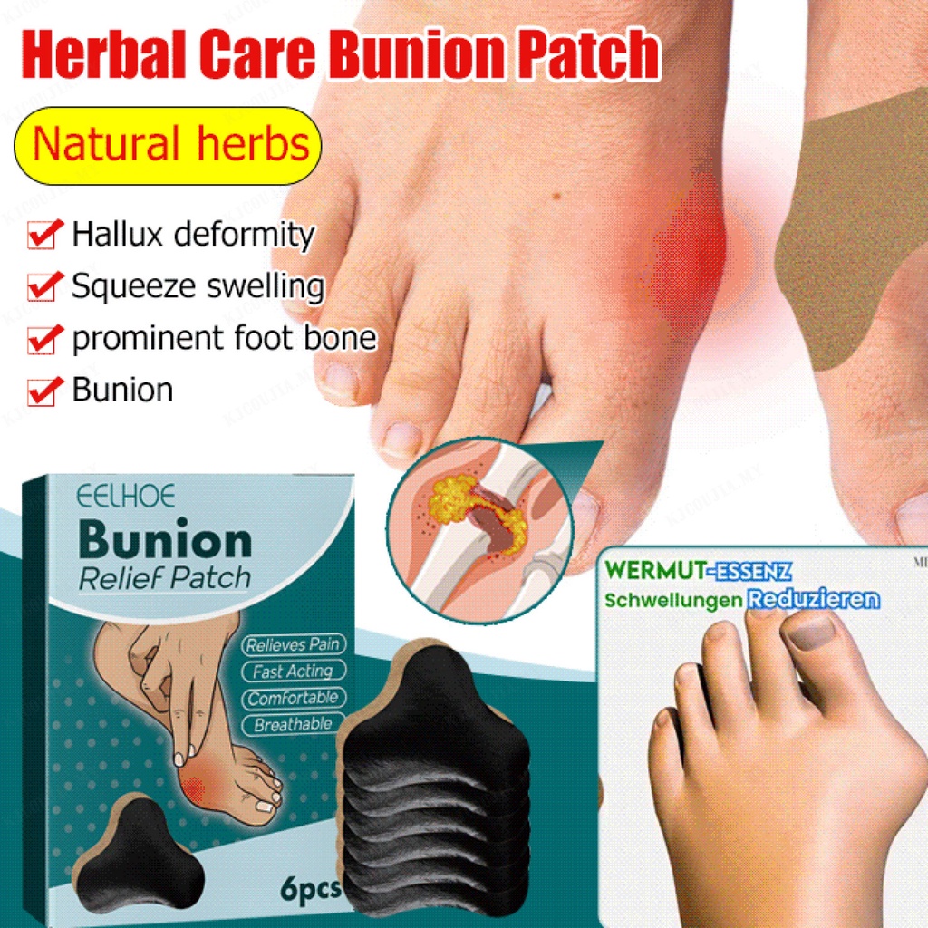Foot Swelling Relief Patch Herbal Remedy for Edema and Inflammation Shopee Malaysia