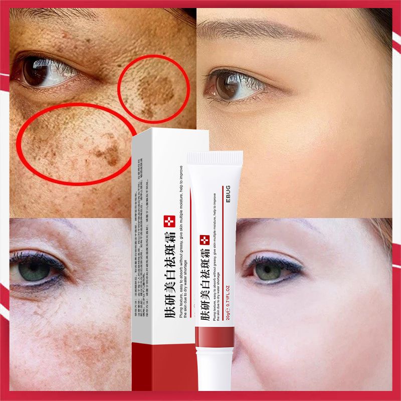 Whitening Freckle Cream Remove Dark Spots Anti Freckle Cream Fade