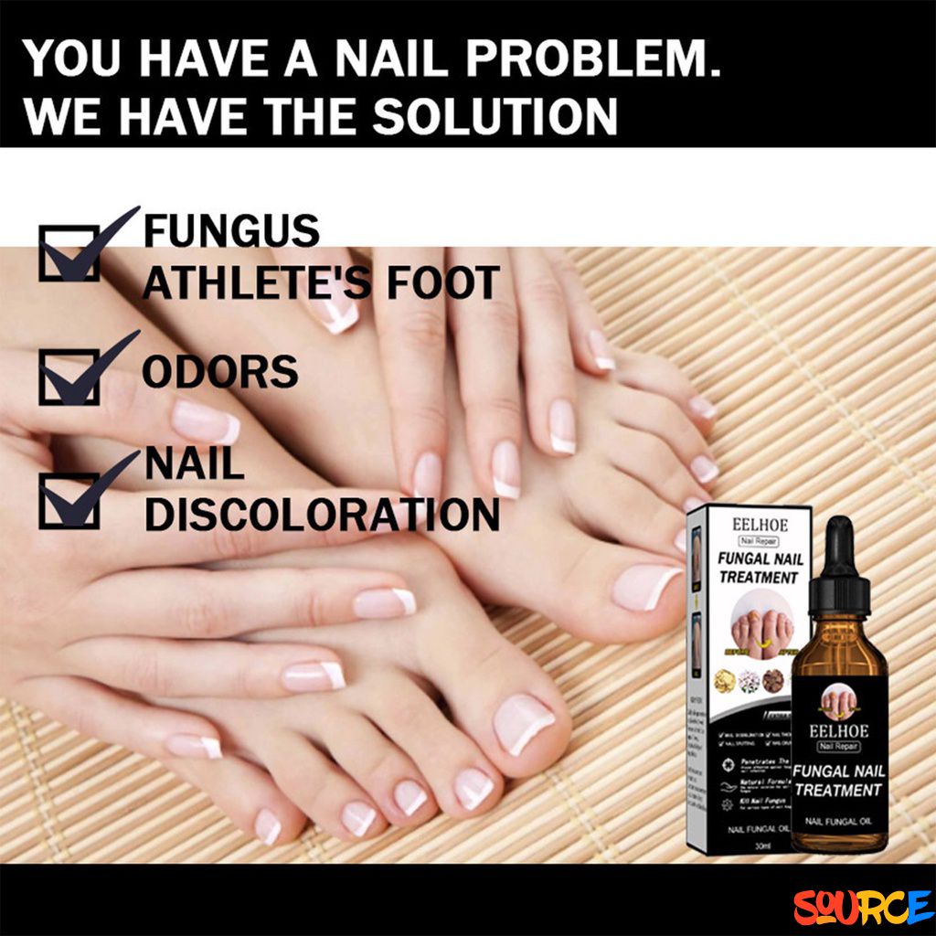 Eelhoe Nail Fungus Treatment Essence Liquid Serum Nail Fungal Treatment