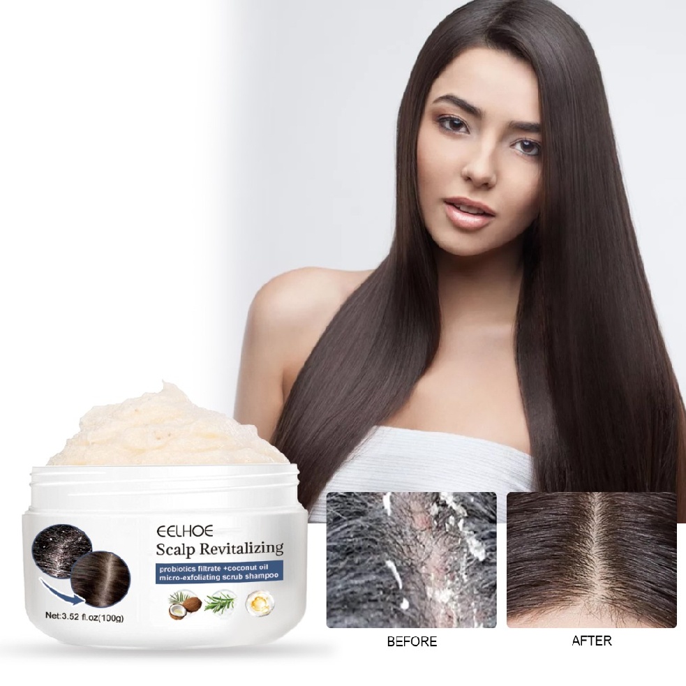 Scalp Scrub Scalp Exfoliator Scalp Treatment for Dry Flaky Itchy Scalp