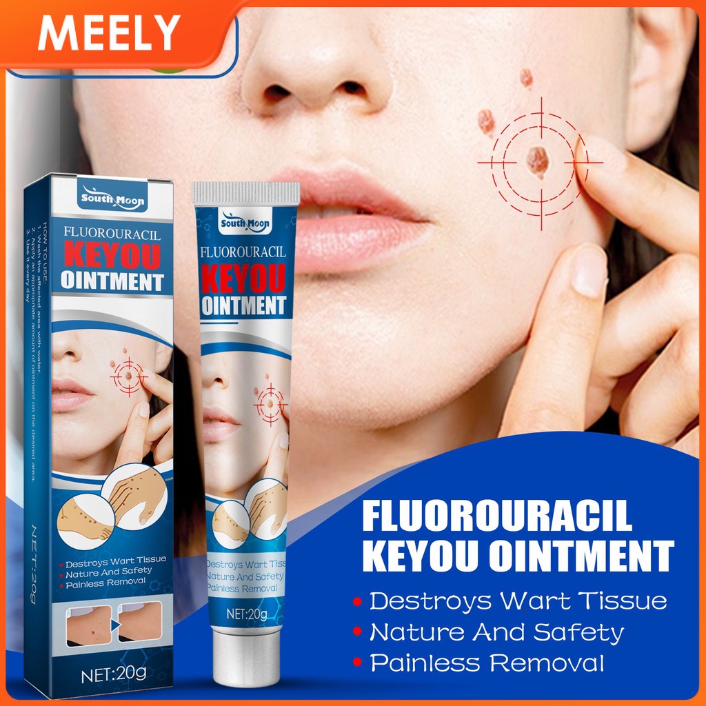 20g South Moon Warts Remover Ointment Skin Tags Removal Natural Extract Gel Face Body Care Mole