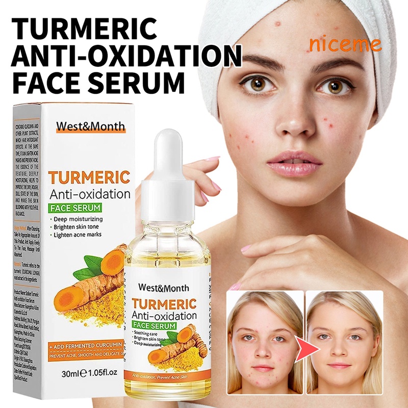 NM11 30ml Turmeric Antioxidation Face Serum,Turmeric Dark Spot