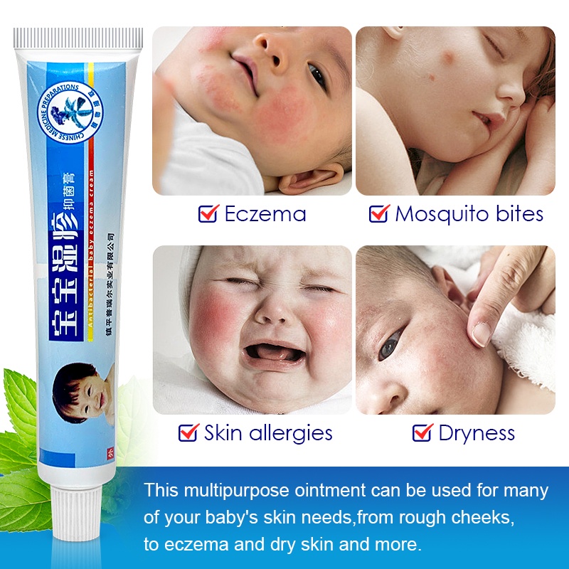 Baby Skin Repair Cream Treatment Kids Diaper Rash Psoriasis Dermatitis ...