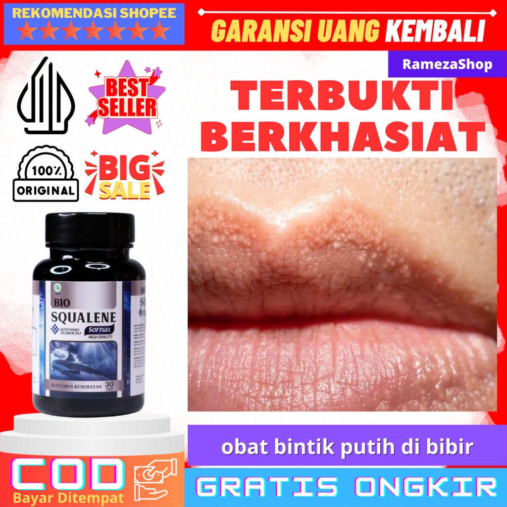 Putih Medicine For White Spots On The Lips Medicine For White Spots