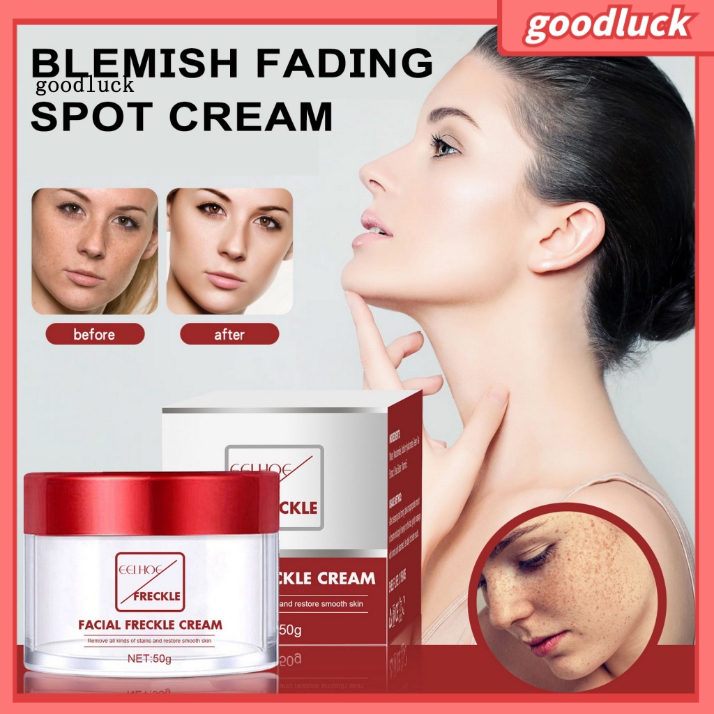 goodluck| Face Cream for Acne Marks Skin Clarifying and Brightening ...